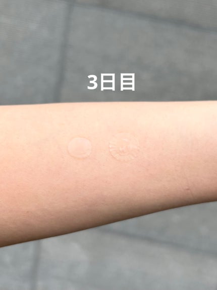 ビューティー スポットパッチ/イージーダムビューティー/にきびパッチを使ったクチコミ(4枚目)