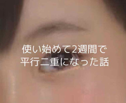 パワーアイリッドフィックス/Decorative Eyes/二重まぶた用アイテムを使ったクチコミ(1枚目)