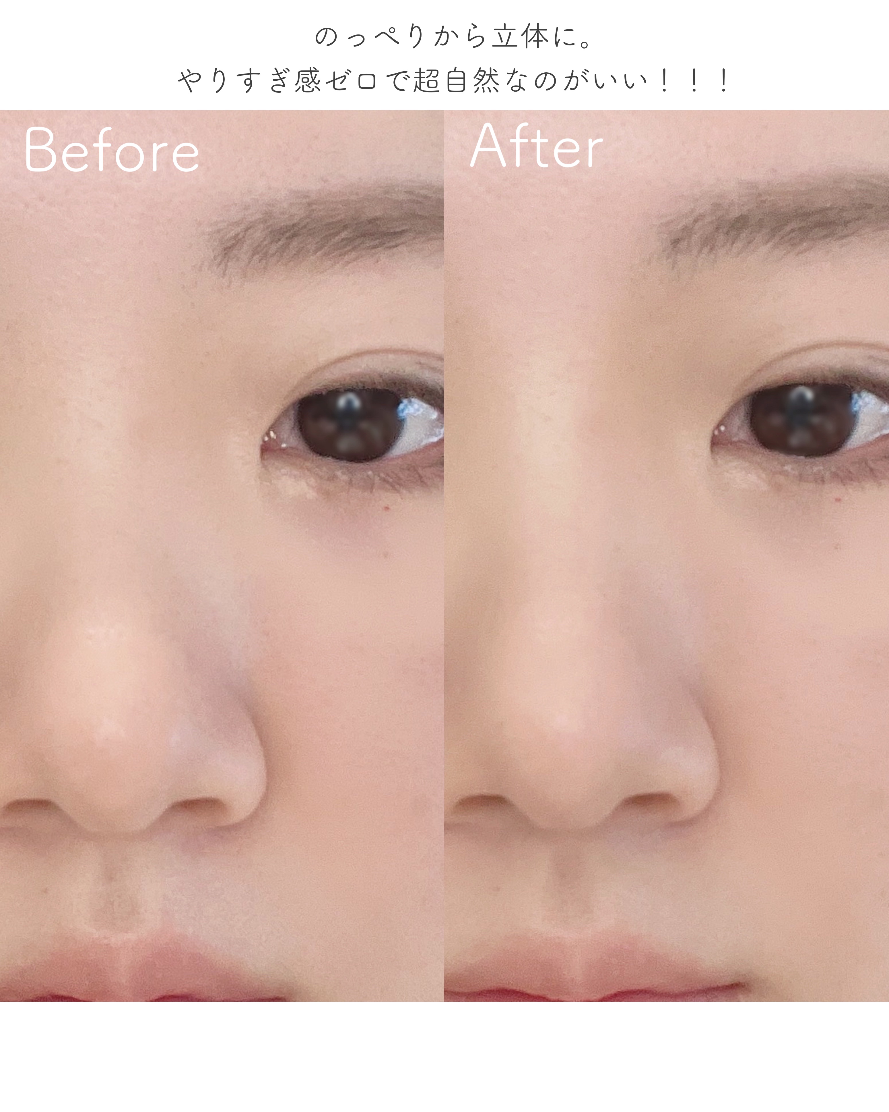 コントゥアスティック/ETUDE/シェーディングを使ったクチコミ（2枚目）