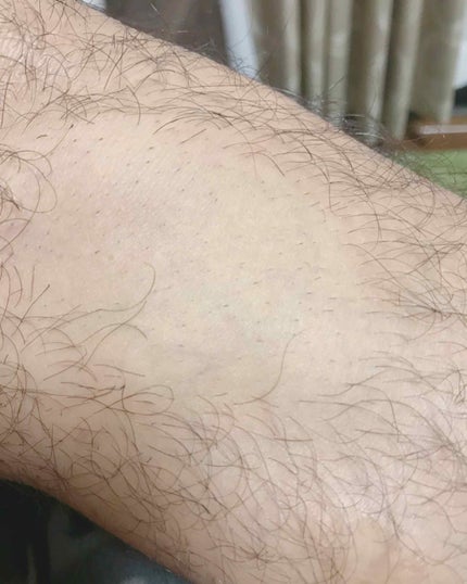 Kmyu(ケミュー)/CONTRIBUTION/除毛クリームを使ったクチコミ(4枚目)