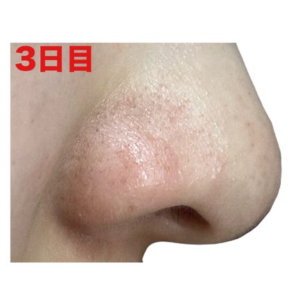 3番 緑茶炭毛穴パッククレンジングバーム/numbuzin/クレンジングバームを使ったクチコミ(6枚目)