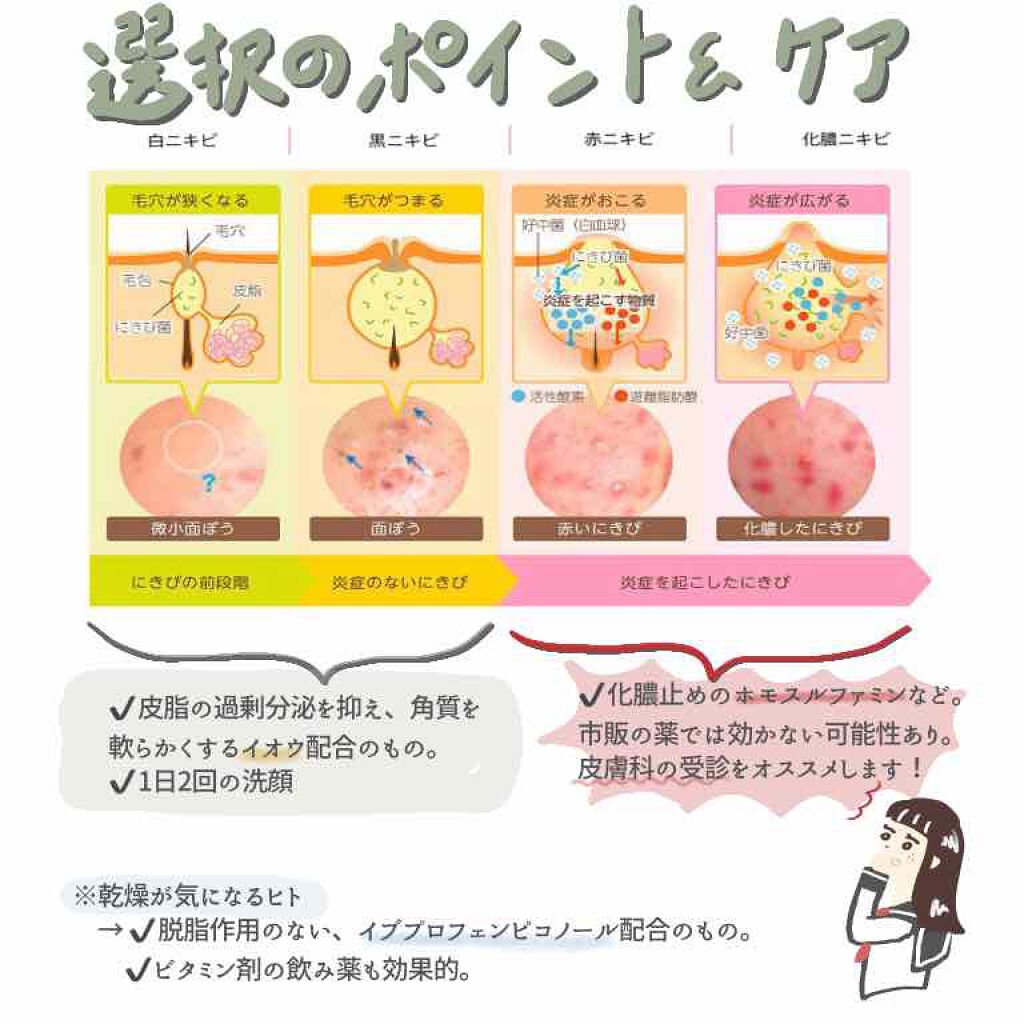 アクネローション/メンターム/化粧水を使ったクチコミ(4枚目)