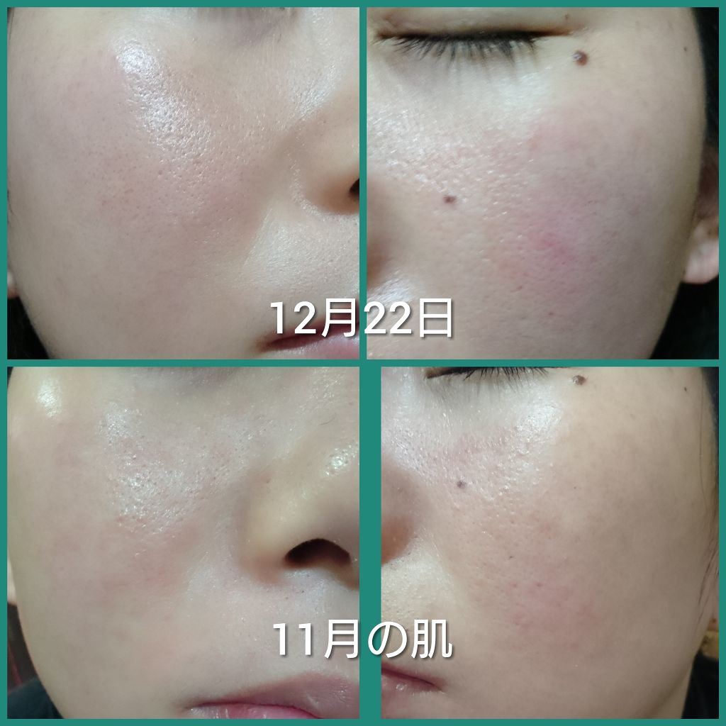 菊正宗 日本酒の化粧水 高保湿/菊正宗/化粧水を使ったクチコミ(2枚目)