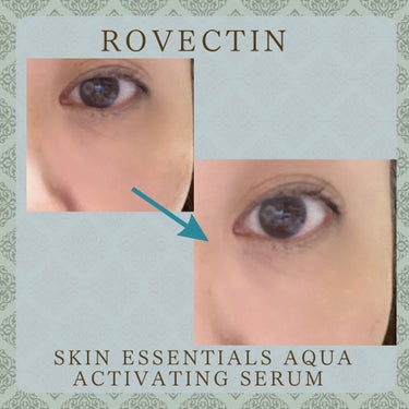 ロベクチン エッセンシャル アクアセラムのクチコミ「#PR

【rovectin ロべクチン】
☆ ͛アクアスキンライン SKIN ESSENTI.....」（3枚目）