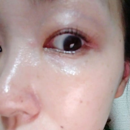 アスハダ-ASHADA-美容液(パーフェクトクリアエッセンス) /アスハダ/美容液を使ったクチコミ(5枚目)