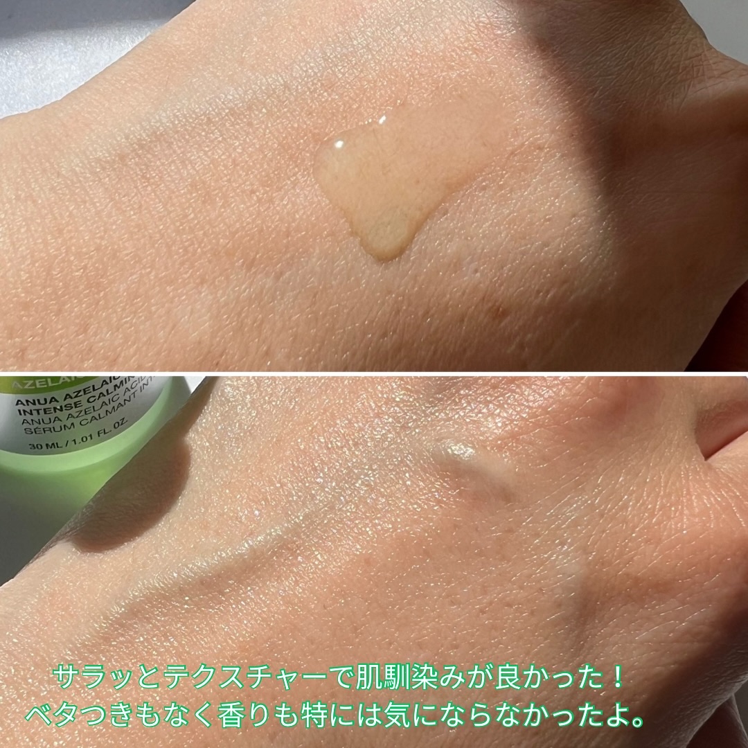アゼライン酸15 インテンスカーミングセラム/Anua/美容液を使ったクチコミ（3枚目）