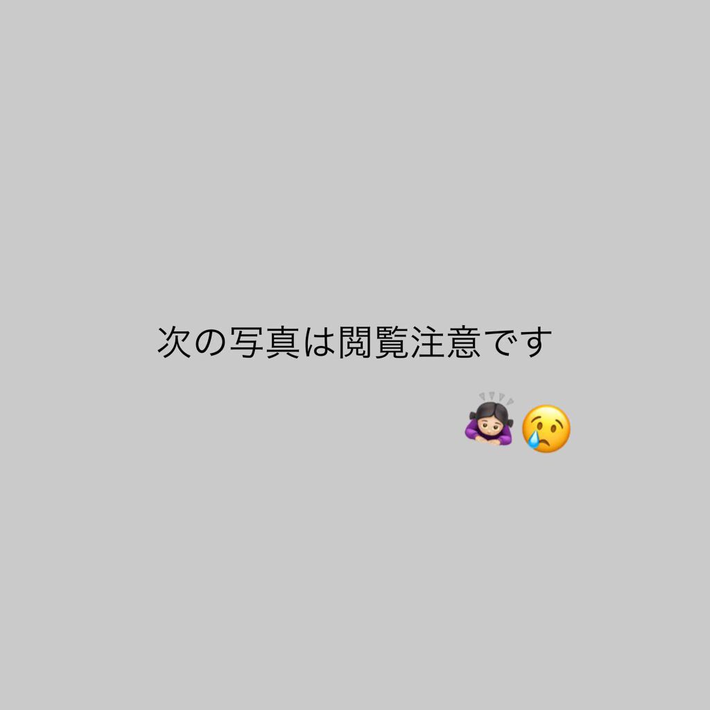 を使ったクチコミ（1枚目）