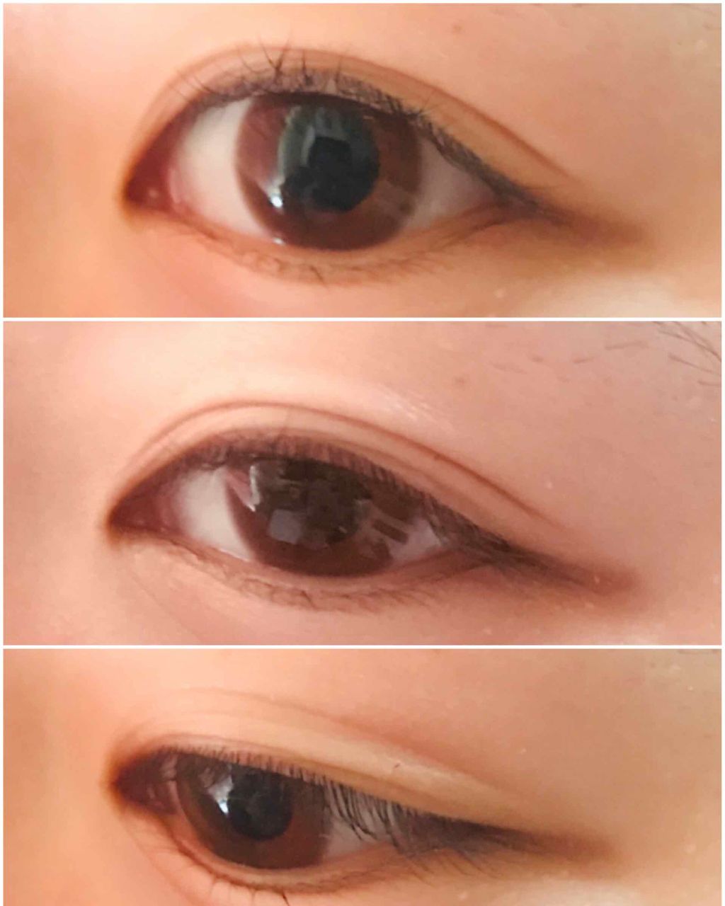 のびーるアイテープ（絆創膏タイプ、レギュラー）/DAISO/二重まぶた用アイテムを使ったクチコミ（2枚目）