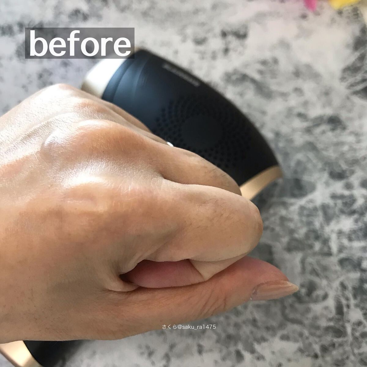 家庭用脱毛器/BLACKRAVE/家庭用脱毛器を使ったクチコミ(3枚目)