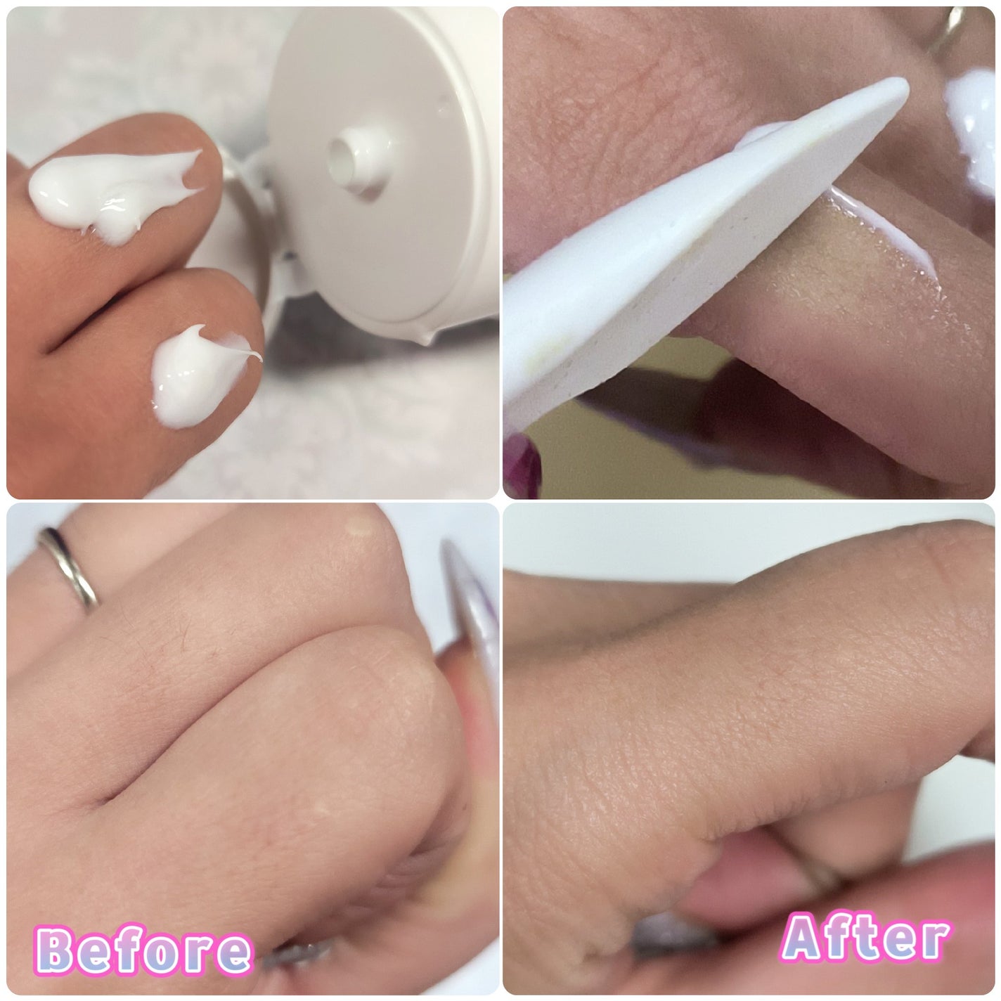 パイナップル豆乳除毛クリーム/鈴木ハーブ研究所/除毛クリームを使ったクチコミ(4枚目)