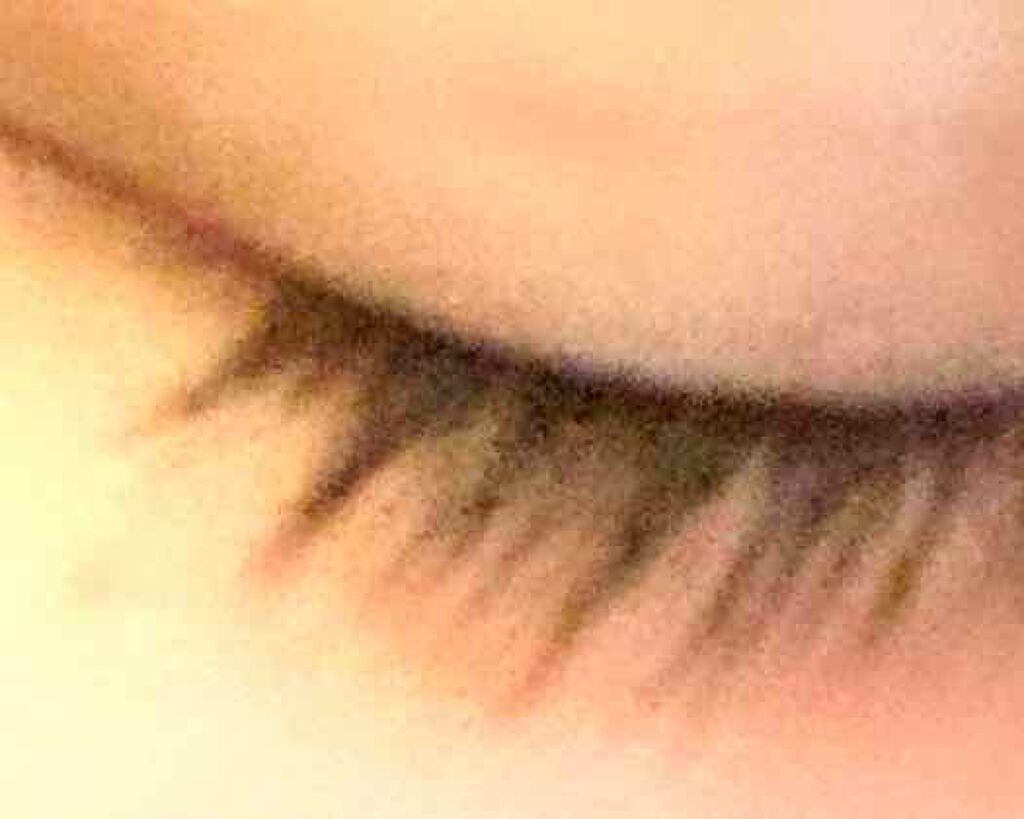 ゆーりかの葉っぱ on LIPS 「術後10日目です✩.*˚なぜか写真右寄りになるんですよね🥺やっ..」(3枚目)