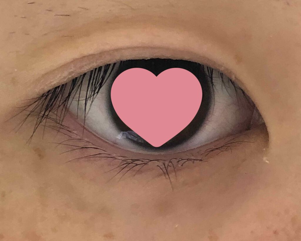 アイビューティー フィクサー WP/アストレア ヴィルゴ/二重まぶた用アイテムを使ったクチコミ（1枚目）