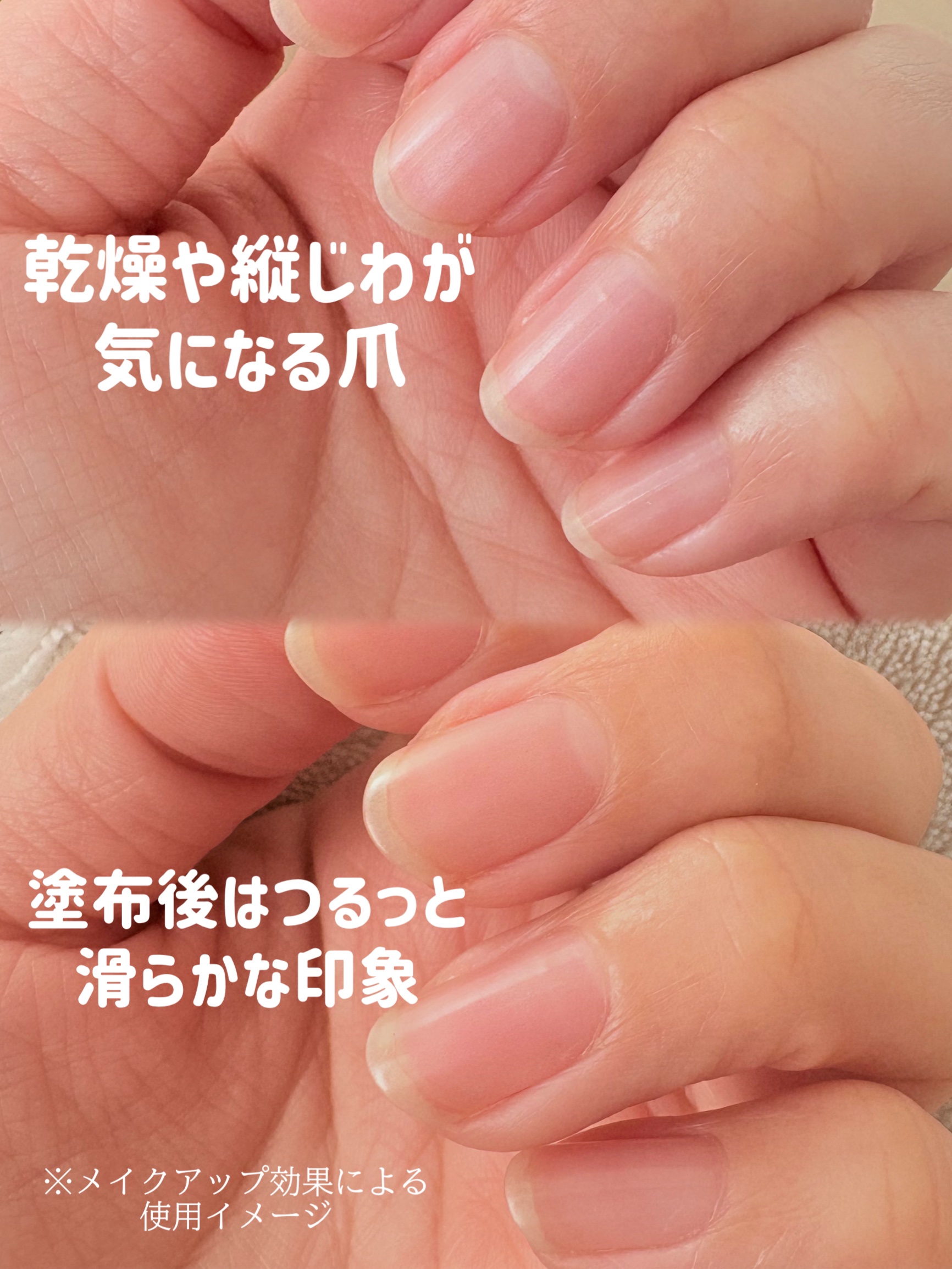 LOKE NAIL CARE PROTECTOR/LOKE/ネイルオイル・トリートメントを使ったクチコミ（3枚目）