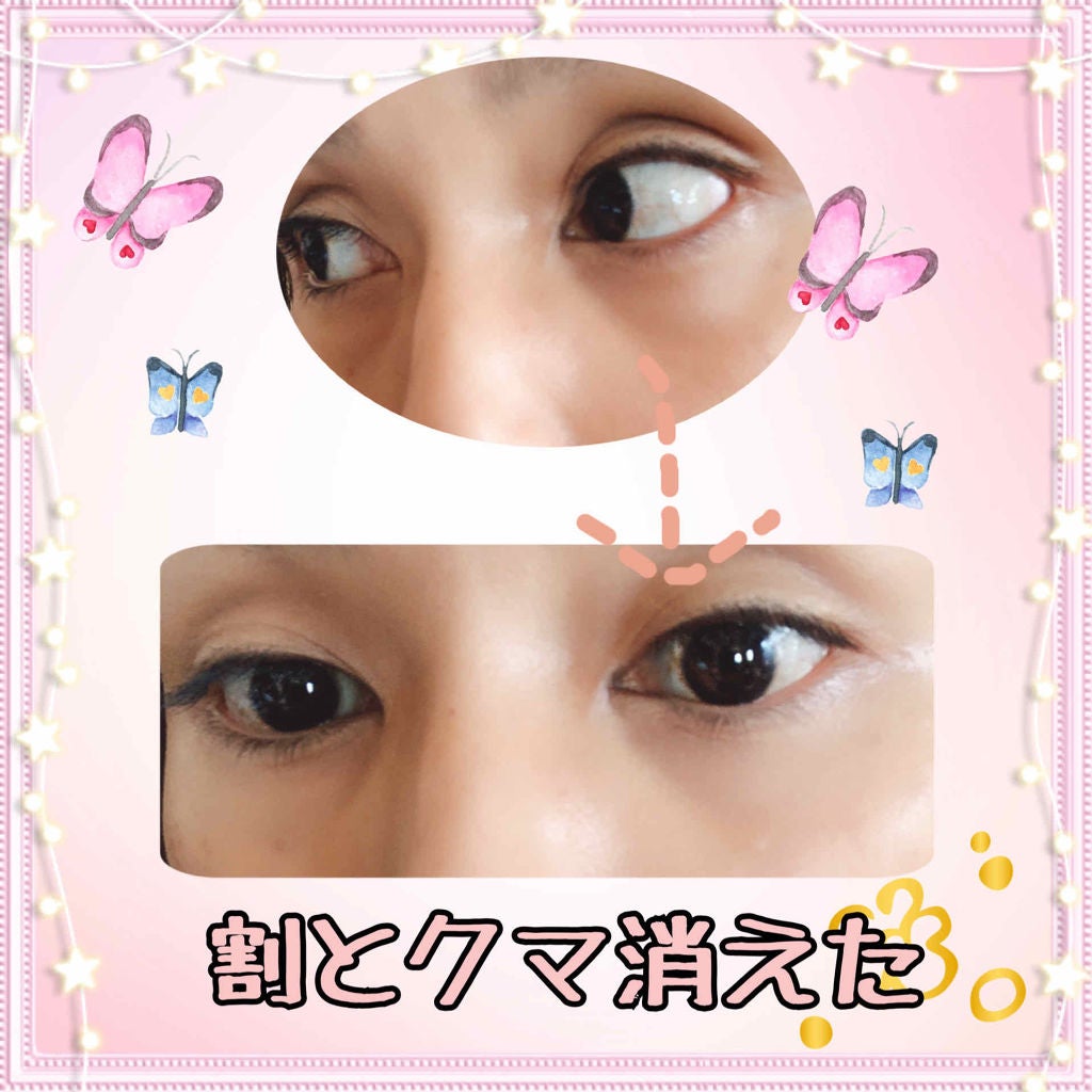 アイゾーンコンシーラー/コフレドール/スティックコンシーラーを使ったクチコミ(3枚目)