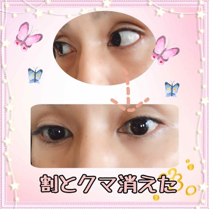 アイゾーンコンシーラー/コフレドール/スティックコンシーラーを使ったクチコミ(3枚目)