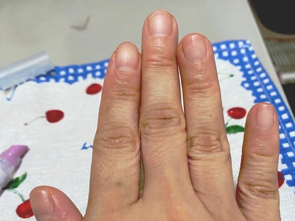 Mimits Moist Cuticle Pen ミミッツ モイストキューティクルペン/ビー・エヌ/ネイル・ネイルケアを使ったクチコミ(3枚目)