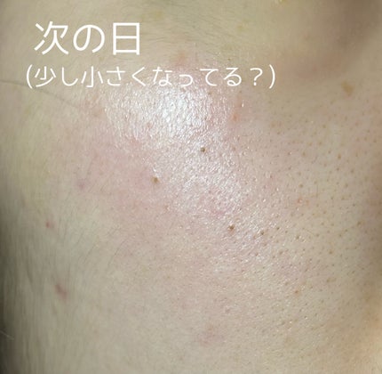 レチノールインテンスデイリーマスク/SOME BY MI/シートマスク・パックを使ったクチコミ(3枚目)
