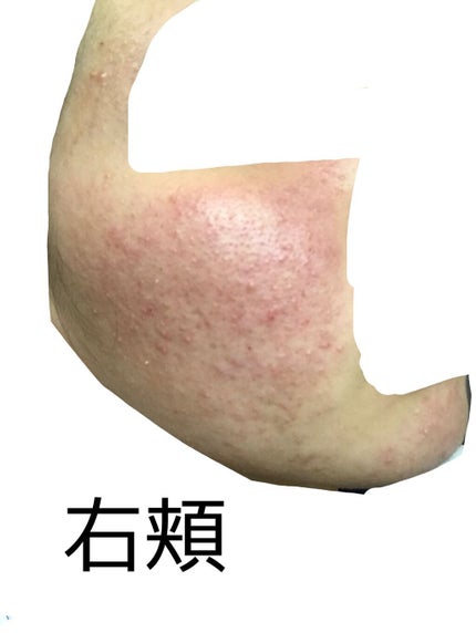 を使ったクチコミ(3枚目)