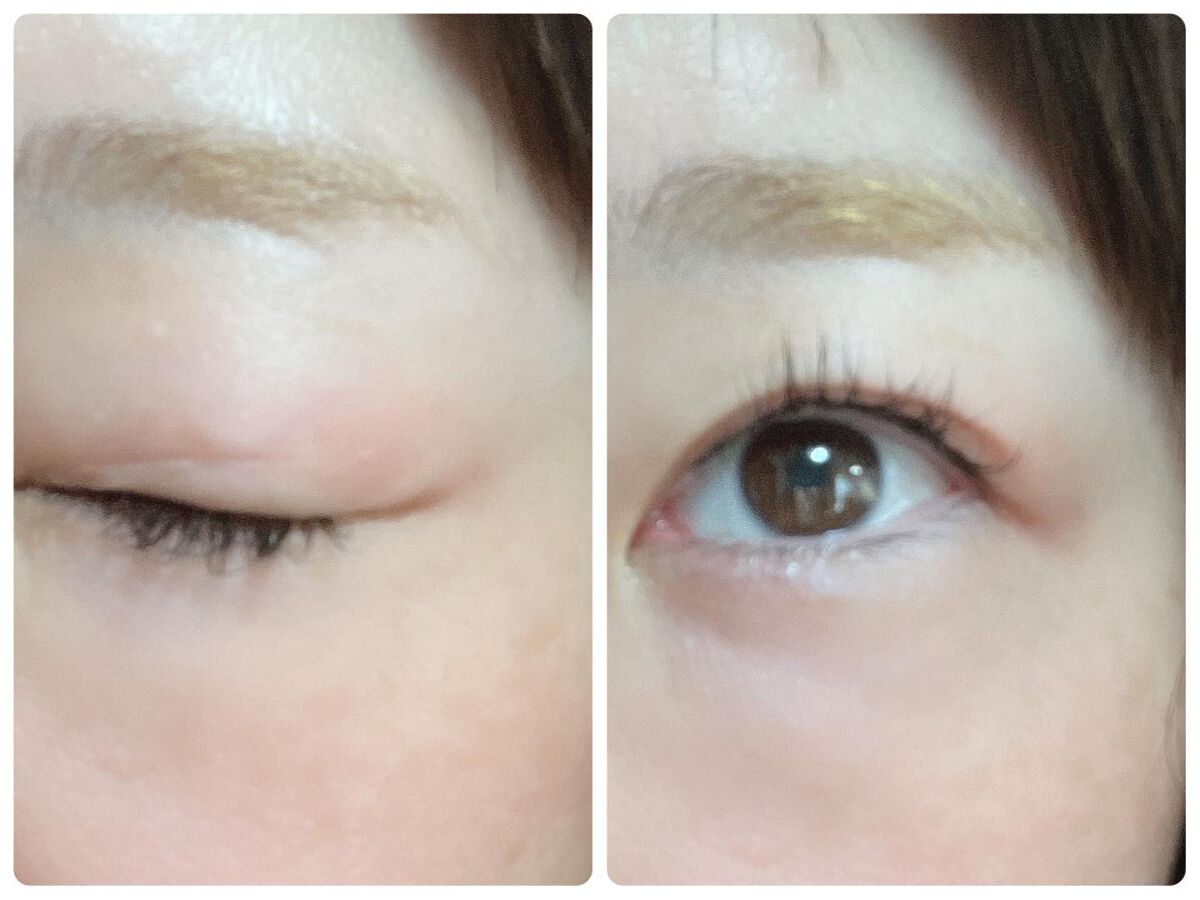 マイクロファイバー /ビー・エヌ/二重まぶた用アイテムを使ったクチコミ(5枚目)