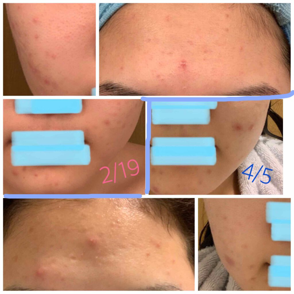 ビジャ スキンケア トライアルセット/innisfree/美容液を使ったクチコミ(2枚目)