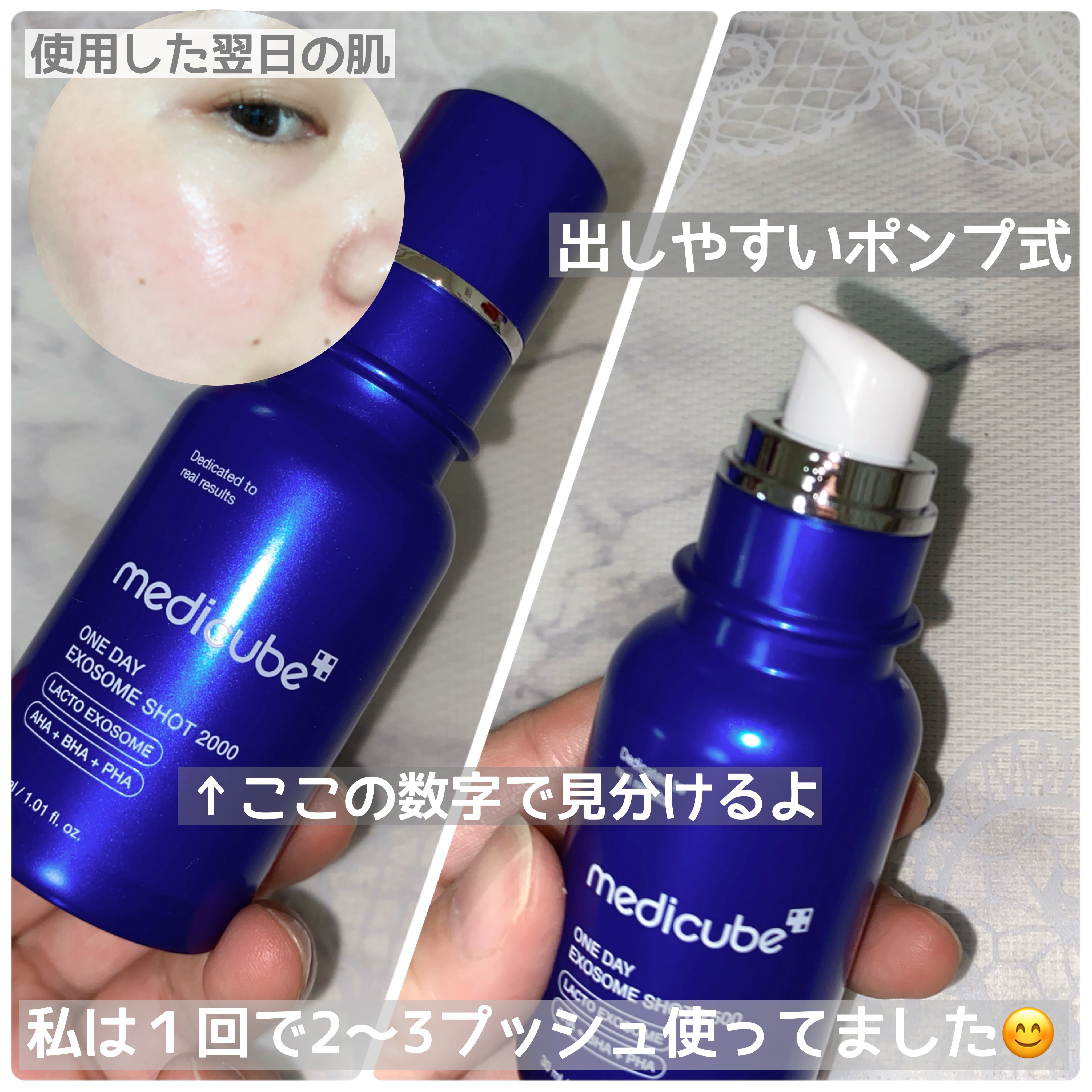 ゼロ1DAYエクソソームショット2000/MEDICUBE/美容液を使ったクチコミ（2枚目）