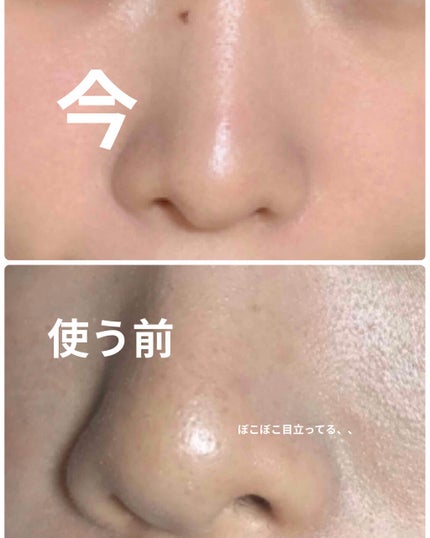 クリーンイットゼロ クレンジングバーム オリジナル/BANILA CO/クレンジングバームを使ったクチコミ(2枚目)