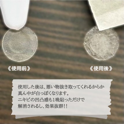 カーミングクリアスポットパッチ/Pyunkang Yul/にきびパッチを使ったクチコミ(7枚目)