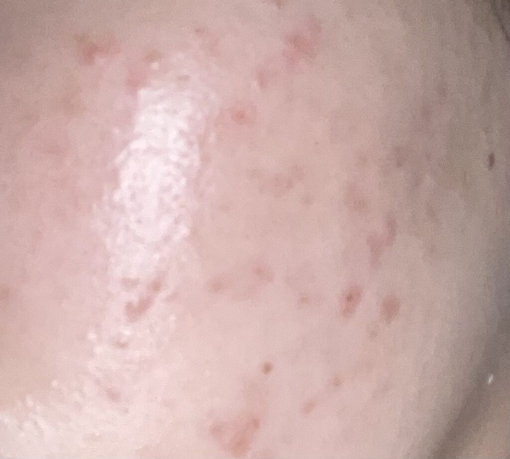 潤浸保湿 化粧水 III とてもしっとり/キュレル/化粧水を使ったクチコミ（1枚目）