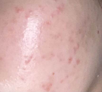 潤浸保湿 化粧水 III とてもしっとり/キュレル/化粧水を使ったクチコミ(1枚目)