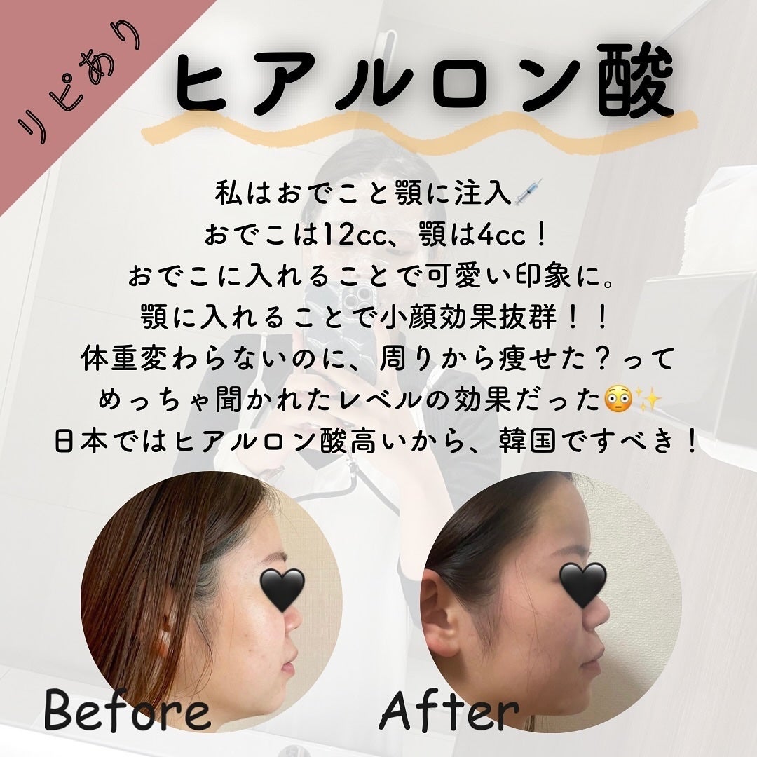 ðððð€ËË on LIPS ããªãããã»ãªããªãçŸå®¹å»çâ»éžïŒã³ããçŠãæããŠçŸå®¹å»çã«ã..ãïŒ3æç®ïŒ