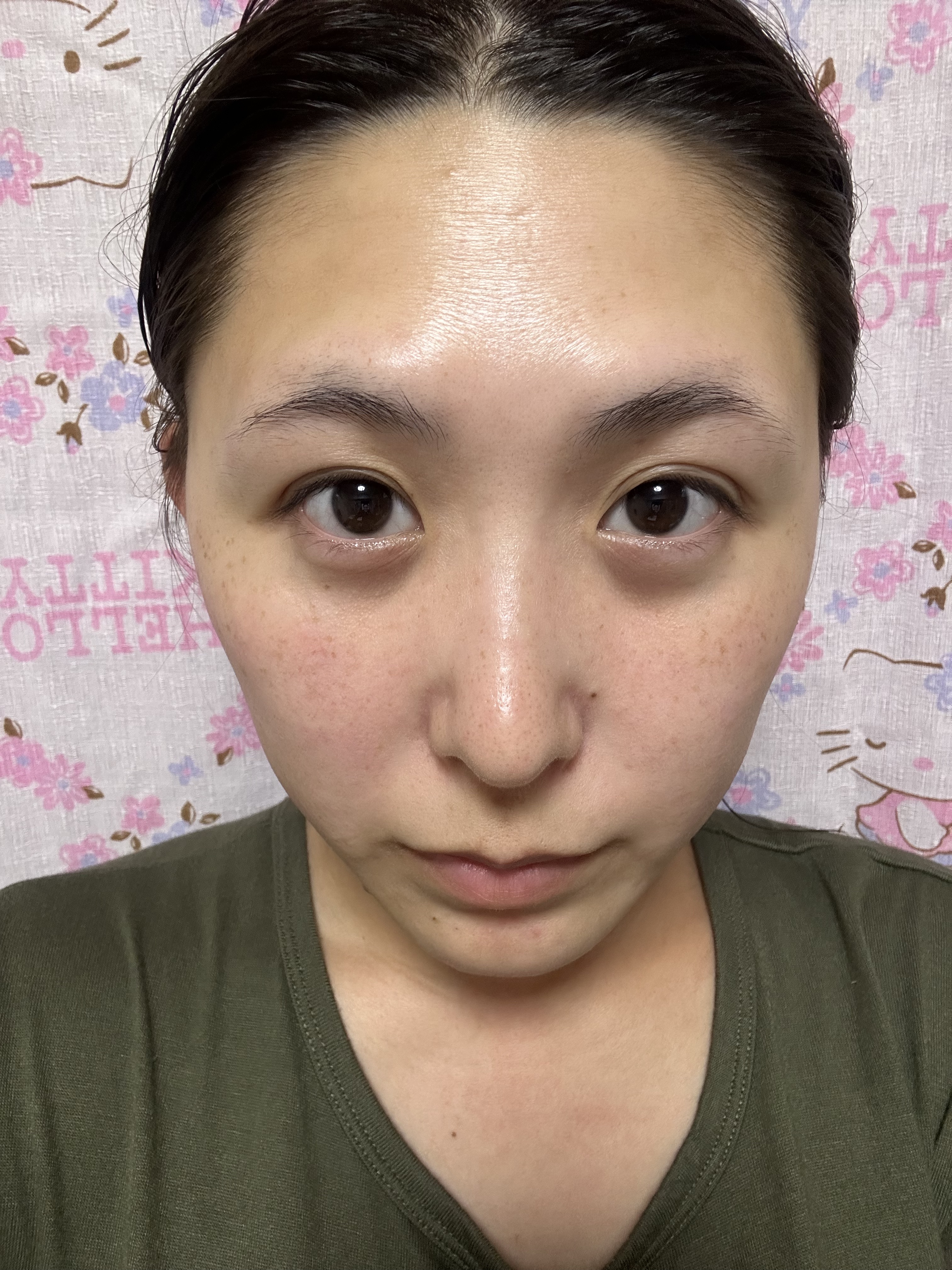 LINDSAY モデリングカップパック クールティーツリーのクチコミ「
美容記録✎‪·͜·⋆꙳

❤️‍🔥LINDSAY モデリングカップパック クールティーツリー.....」（3枚目）