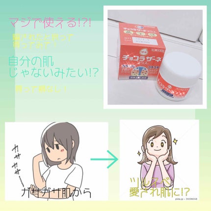 チョコラザーネ プラス(医薬品)/エーザイ/その他を使ったクチコミ(2枚目)