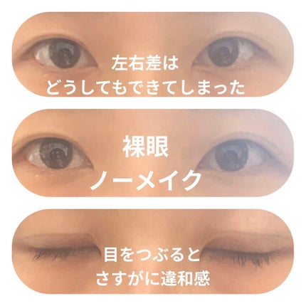 アイビューティー フィクサー WP/アストレア ヴィルゴ/二重まぶた用アイテムを使ったクチコミ(2枚目)