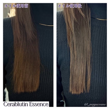 セラブルーチンエッセンス/Epunol/アウトバストリートメントを使ったクチコミ(6枚目)