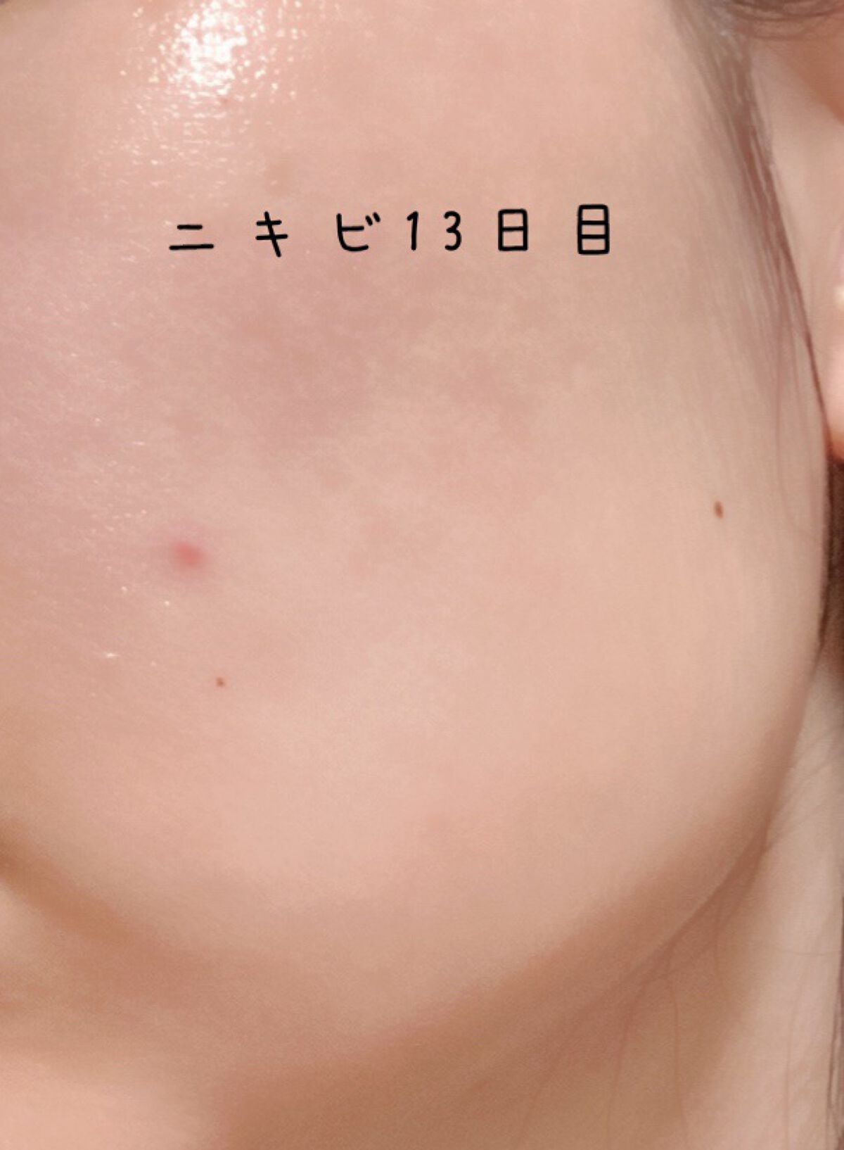 RMK Wトリートメントオイル/RMK/ブースター・導入液を使ったクチコミ（1枚目）