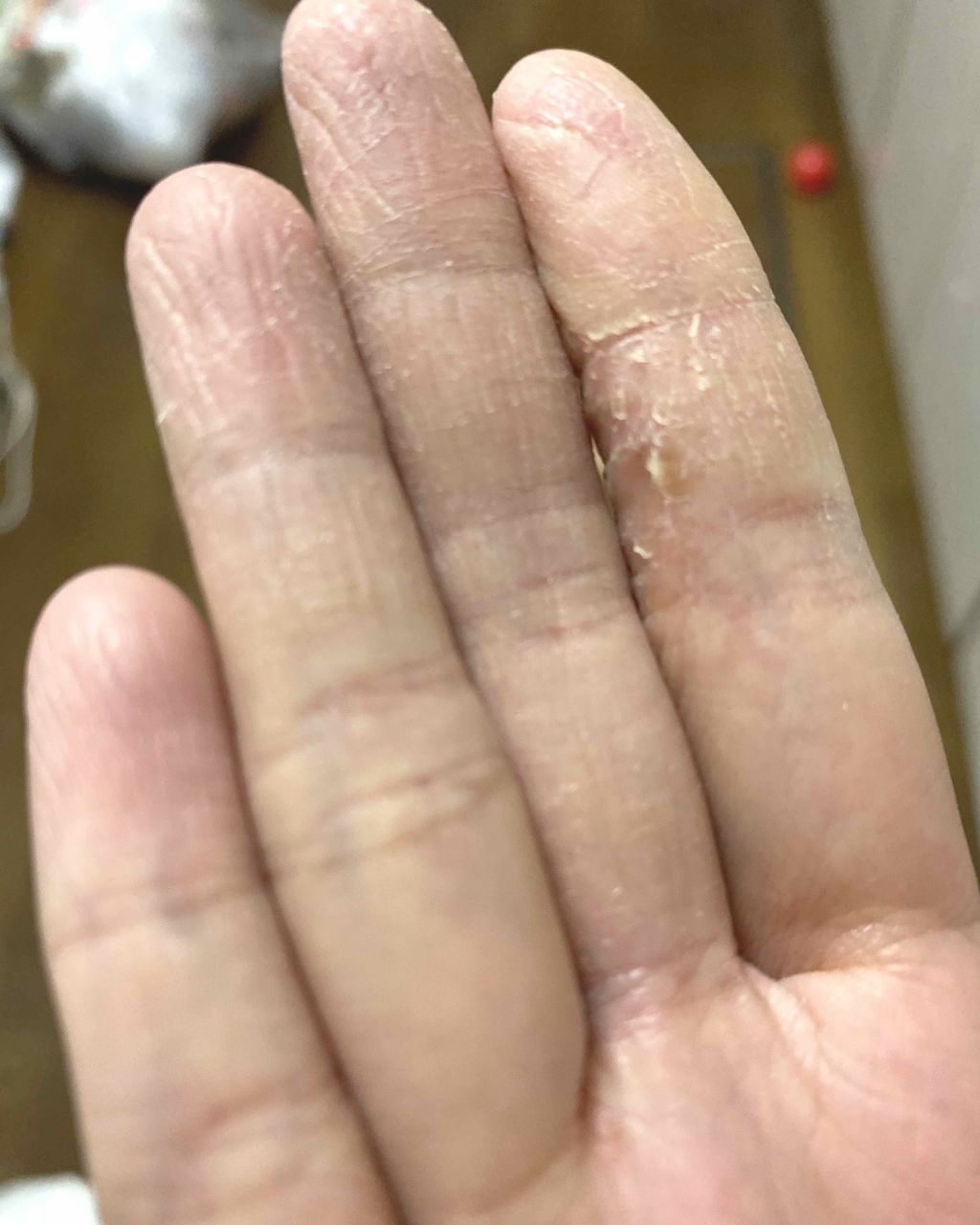 薬用美白ハンドクリーム/ALBLANC/ハンドクリームを使ったクチコミ(2枚目)