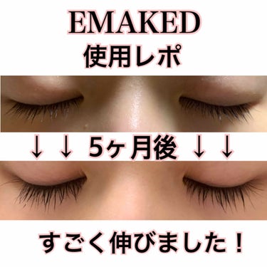 EMAKED（エマーキット）/水橋保寿堂製薬/まつげ美容液を使ったクチコミ（1枚目）