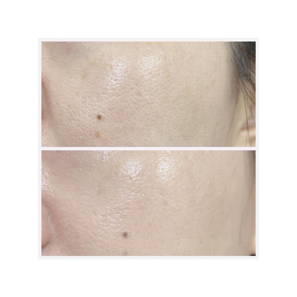 スピキュールリフト ファンデーション ナチュラルオークル /WrinkFade/その他ファンデーションを使ったクチコミ(4枚目)