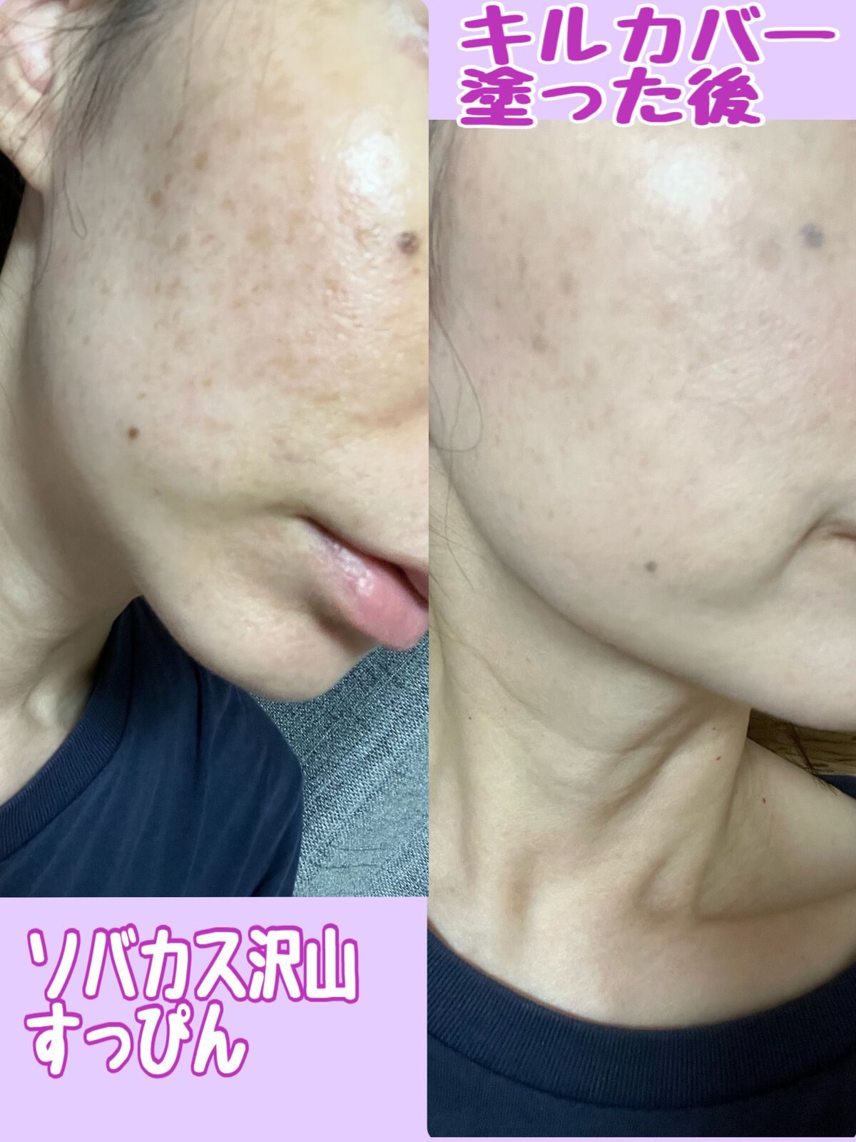 キル カバー フィクサー クッション/CLIO/クッションファンデーションを使ったクチコミ(4枚目)