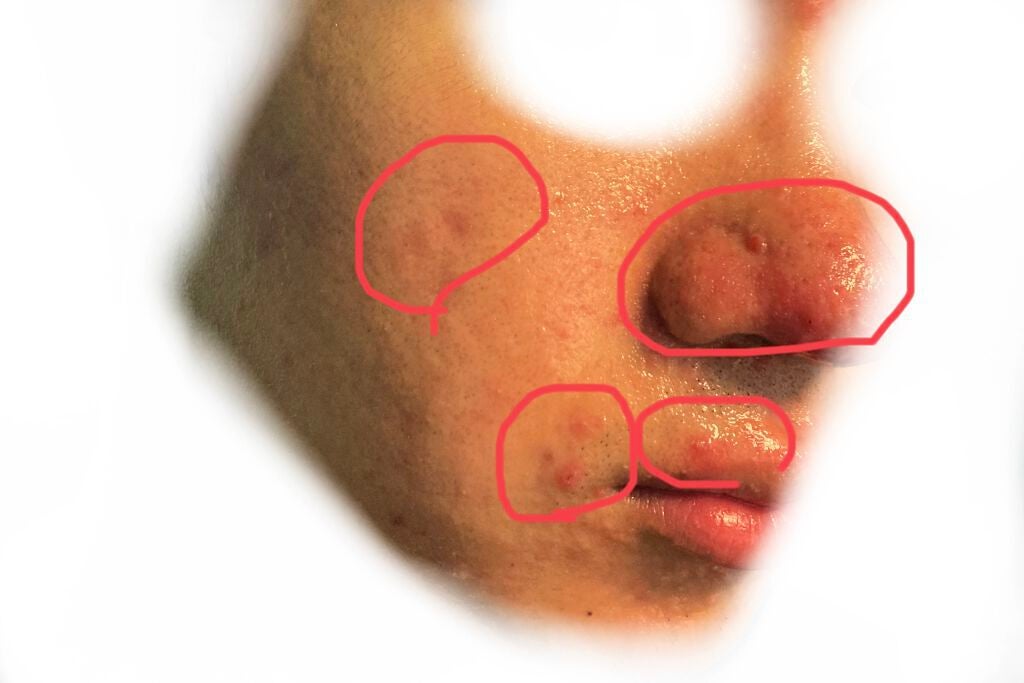 (フォロバ)3年後に韓国美男子 on LIPS 「CICA×HYALONフェスパック使用回数:5枚目潤う!2枚目..」(3枚目)