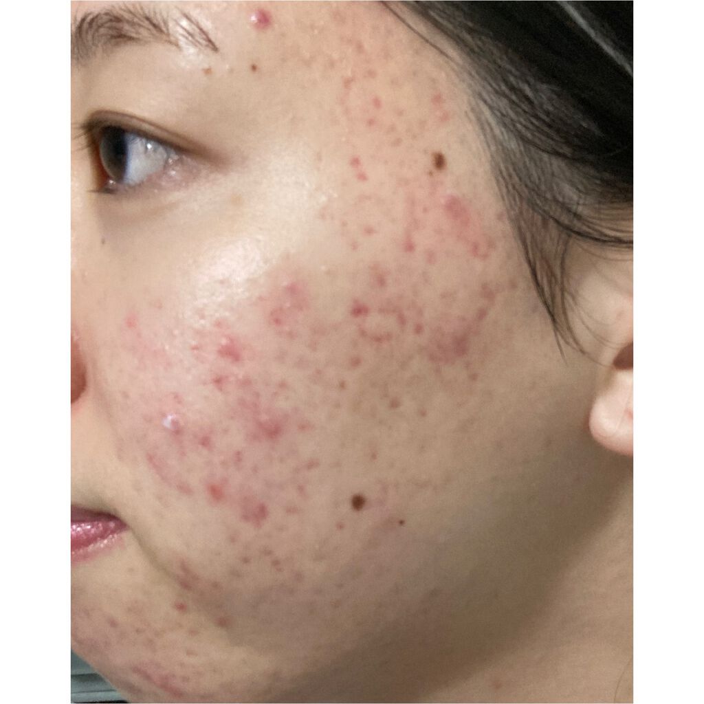 プロポリス エネルギーアンプル/CNP Laboratory/美容液を使ったクチコミ(2枚目)