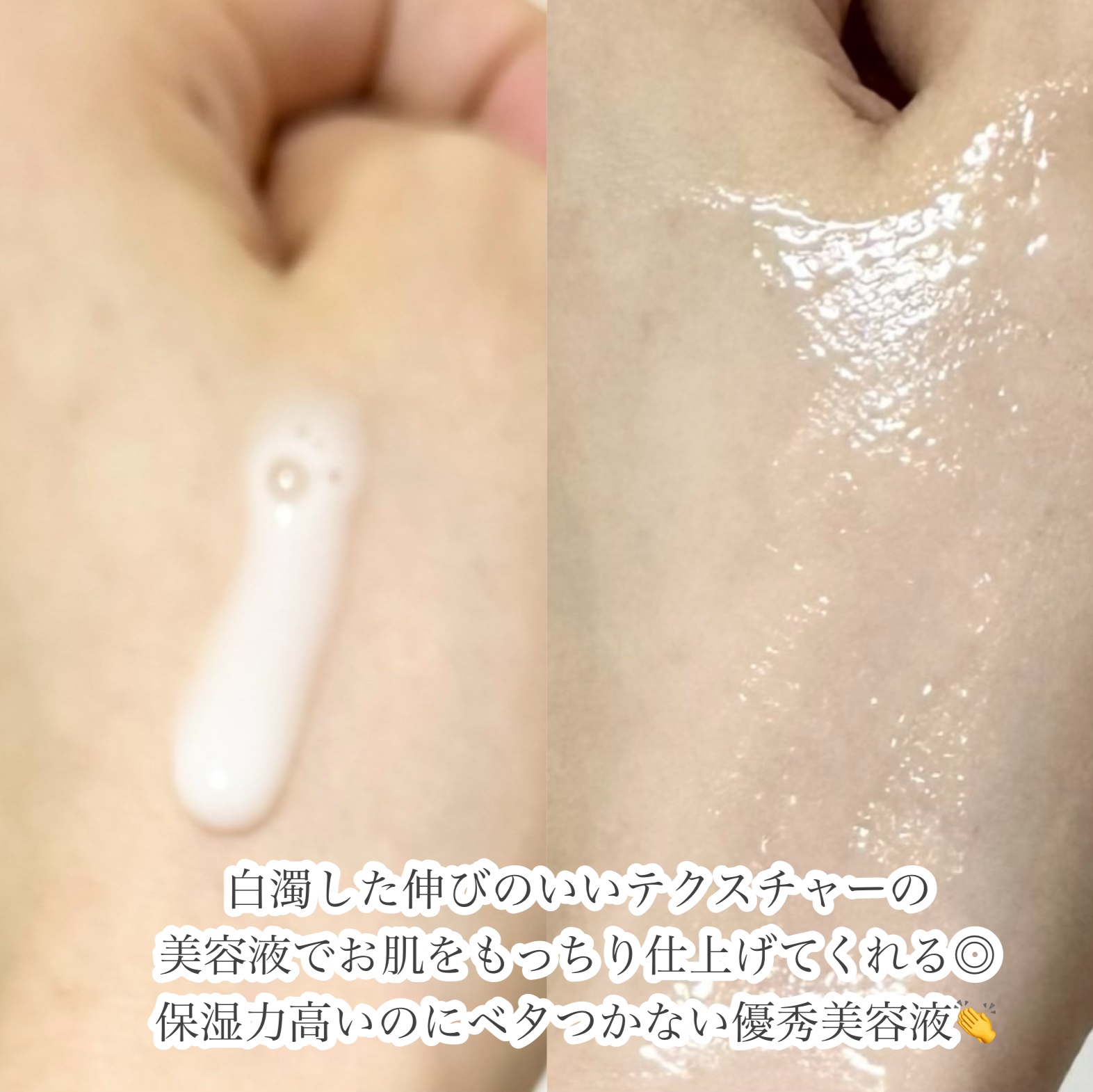 エクストリームクリームアンプル/Real Barrier/美容液を使ったクチコミ（3枚目）