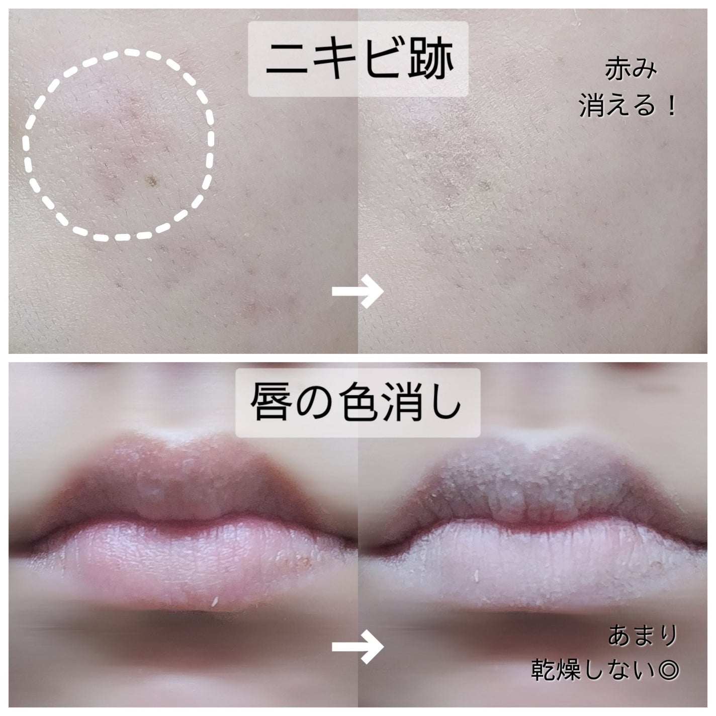 リシェ レッドトリック アイコンシーラー/Visée/パレットコンシーラーを使ったクチコミ(5枚目)