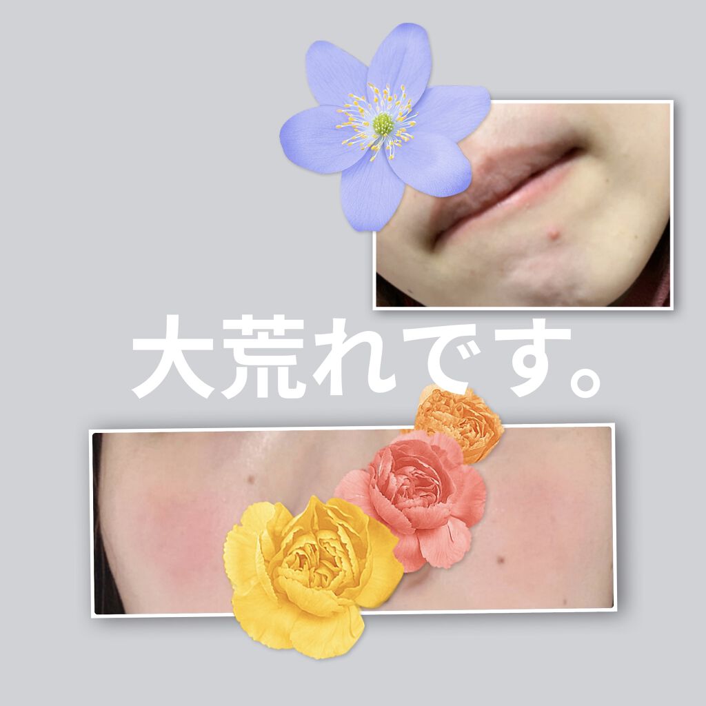 デュオ ザ 薬用クレンジングバーム バリア【医薬部外品】/DUO/クレンジングバームを使ったクチコミ（3枚目）