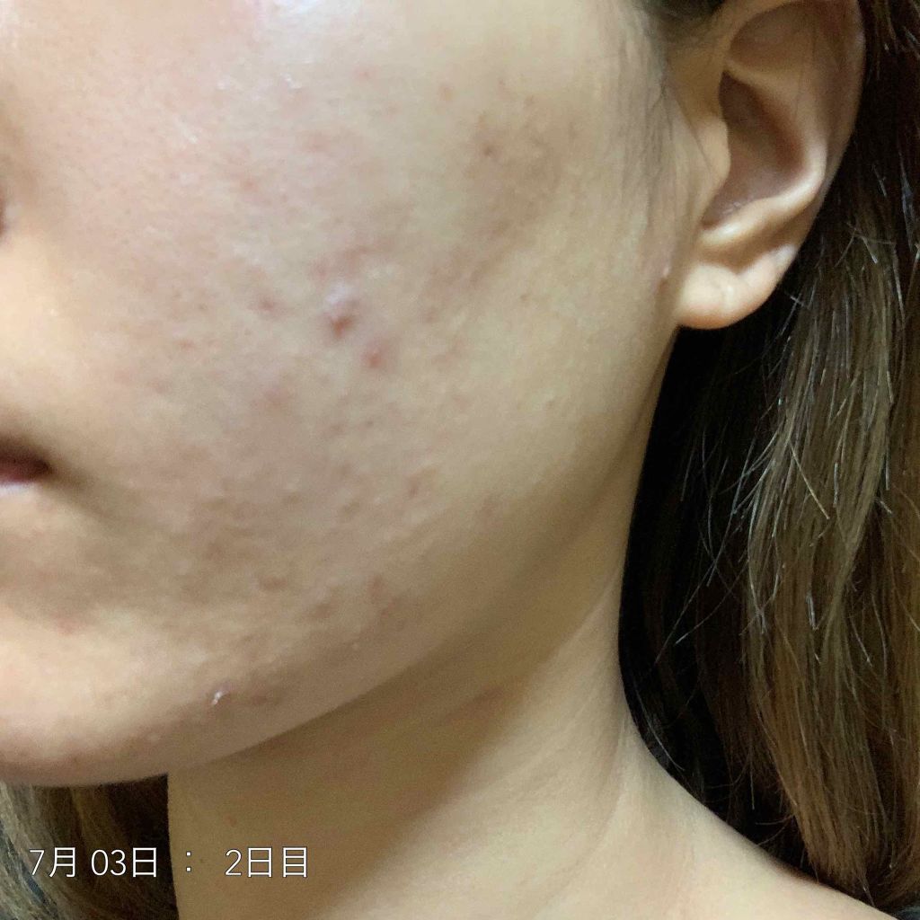 ハトムギ保湿ジェル(ナチュリエ スキンコンディショニングジェル)/ナチュリエ/美容液を使ったクチコミ（3枚目）