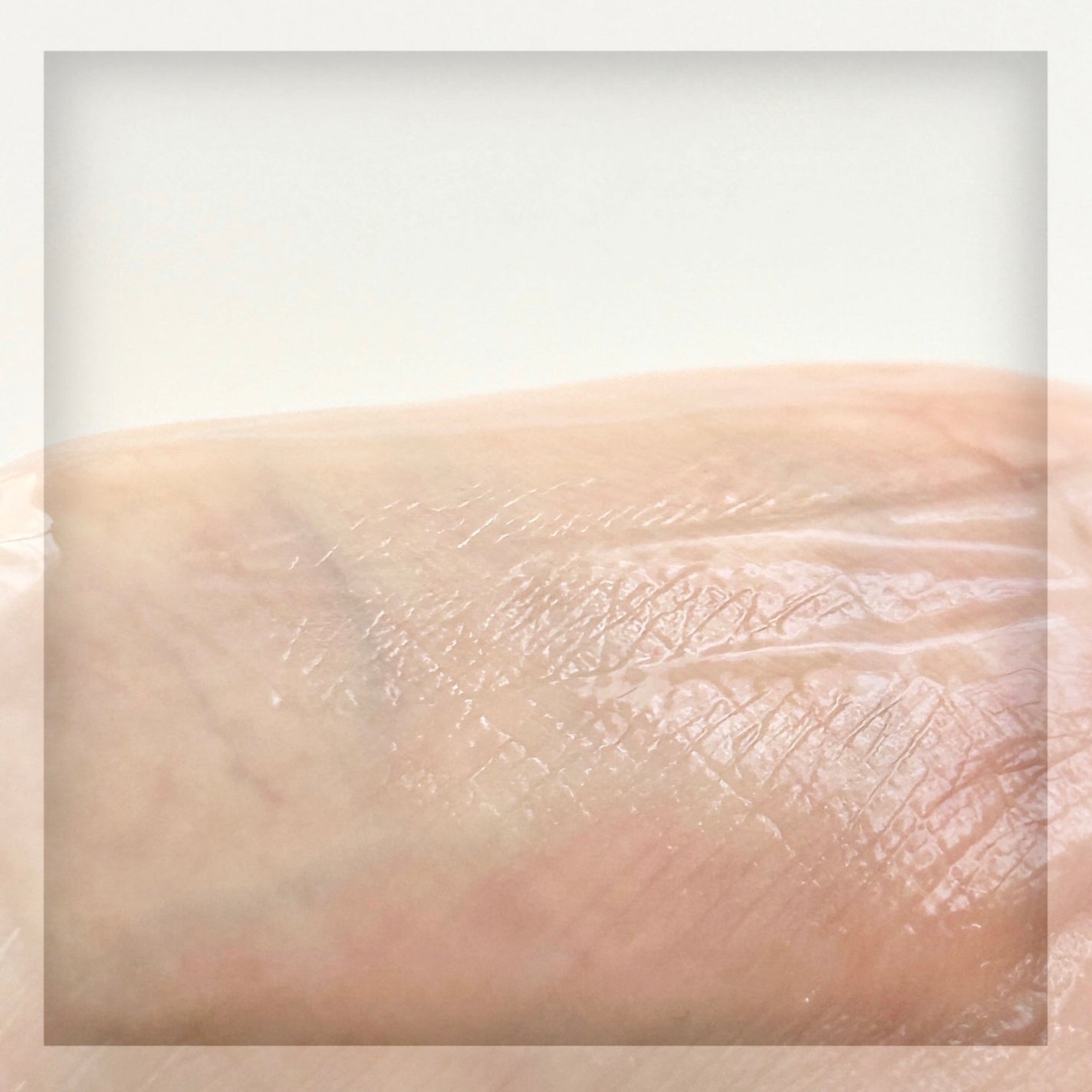 インモトックス小顔リフトアップペプチドショットクリーム&吸引ジェット/MEDITHERAPY/フェイスクリームを使ったクチコミ(4枚目)