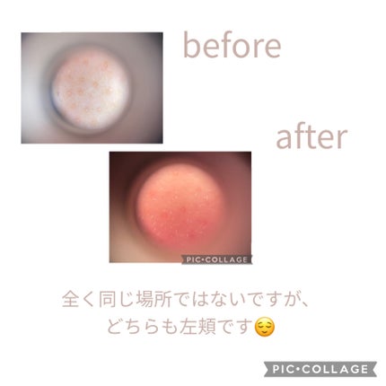 リードルショット300/VT/美容液を使ったクチコミ(3枚目)