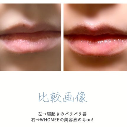 リップ美容液/WHOMEE/リップ美容液を使ったクチコミ(2枚目)