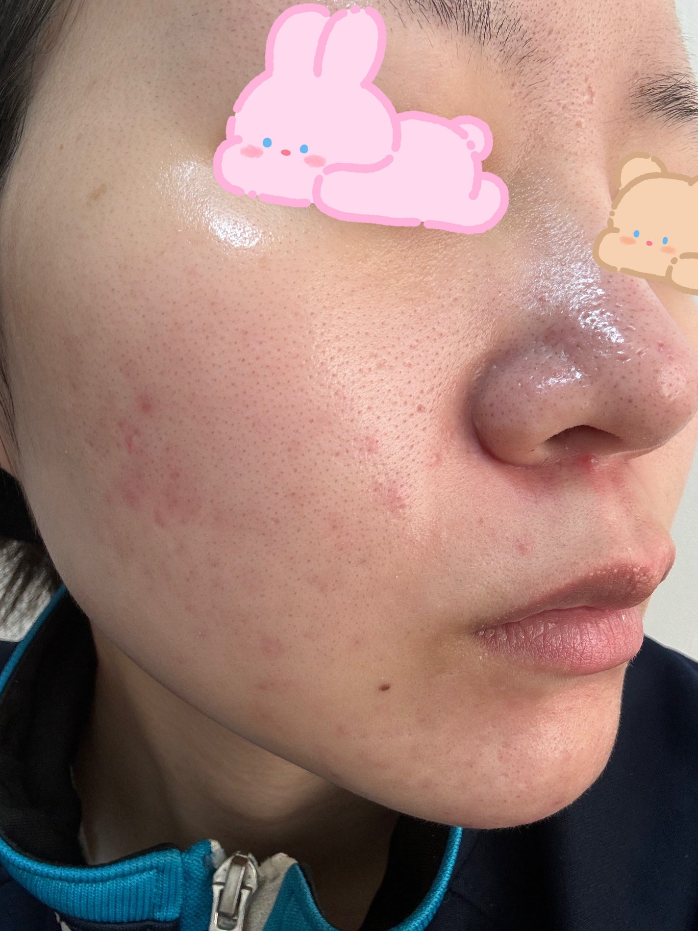 白潤 薬用美白化粧水(しっとりタイプ)/肌ラボ/化粧水を使ったクチコミ(3枚目)