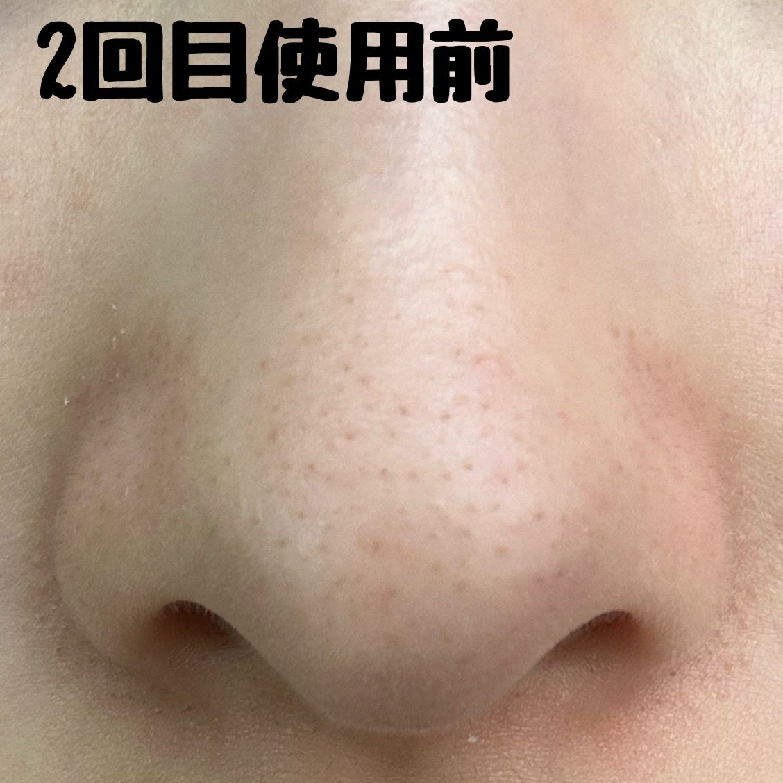 ノーモアブラックヘッド(ノーズピーリング)/One-day's you/スクラブ・ゴマージュを使ったクチコミ(3枚目)